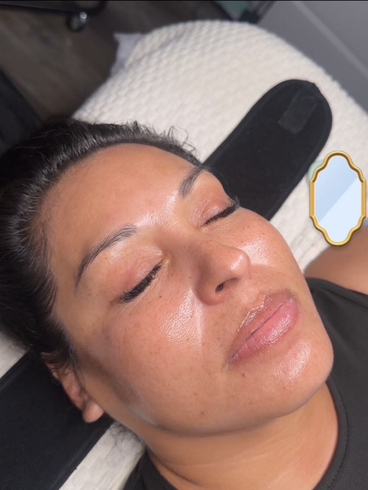 After: the same client resting with eyes closed, her skin looking smooth, even and luminous.